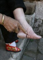 Bound feet of Chinese lady